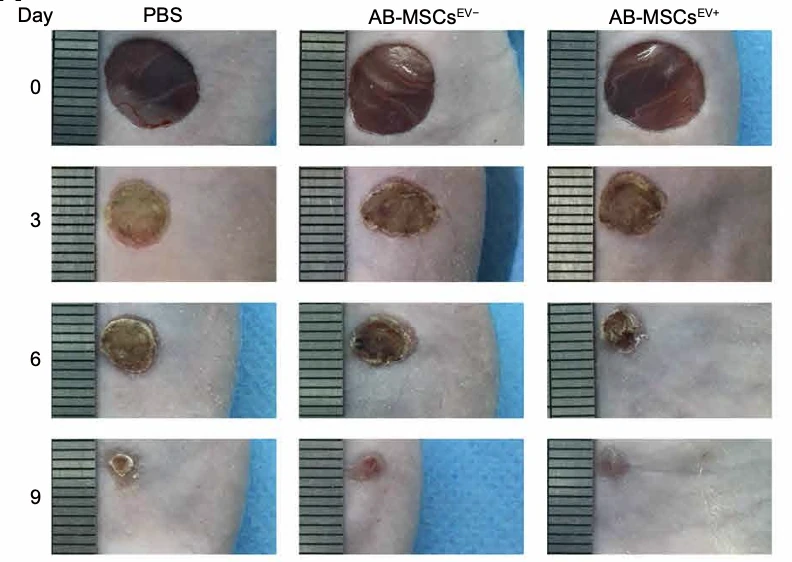 Extracellular vesicles deposit
            <i>PCNA</i>
            to rejuvenate aged bone marrow–derived mesenchymal stem cells and slow age-related degeneration