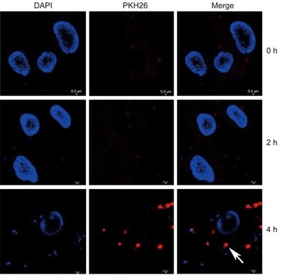 BCR-ABL1-positive microvesicles malignantly transform human bone marrow mesenchymal stem cells in vitro