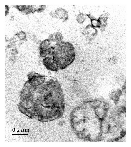 Mesenchymal Stem Cell‐Derived Microvesicles Support Ex Vivo Expansion of Cord Blood‐Derived CD34<sup>+</sup> Cells