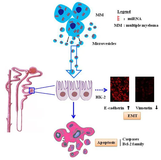 Tumor Cell-Derived Microvesicles Induced Not Epithelial-Mesenchymal Transition but Apoptosis in Human Proximal Tubular (HK-2) Cells: Implications for Renal Impairment in Multiple Myeloma