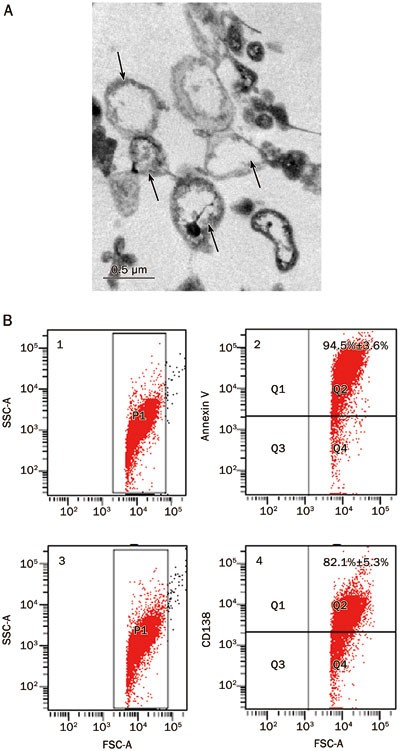 Microvesicles secreted from human multiple myeloma cells promote angiogenesis
