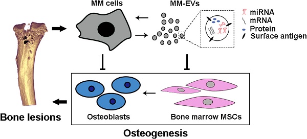Tumor-derived extracellular vesicles inhibit osteogenesis and exacerbate myeloma bone disease