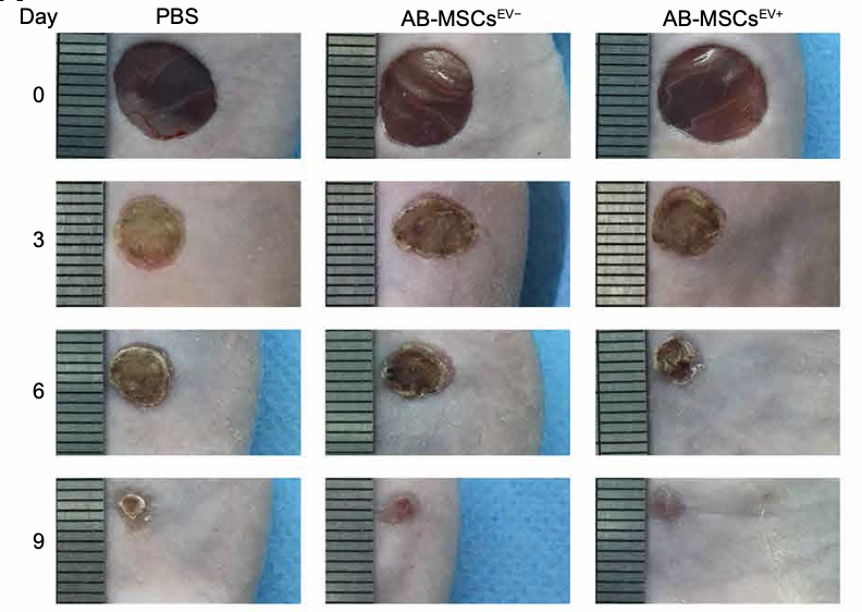 Extracellular vesicles deposit
            <i>PCNA</i>
            to rejuvenate aged bone marrow–derived mesenchymal stem cells and slow age-related degeneration