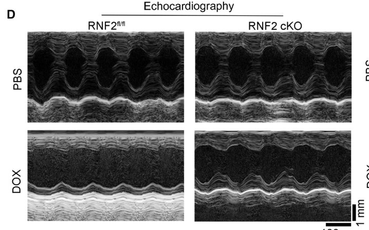 Ring Finger Protein 2 Promotes Oxidative Stress and Mitochondrial Dysfunction in Doxorubicin-Induced Cardiotoxicity Via the Mercaptopyruvate Sulfurtransferase/Hydrogen Sulfide Pathway
