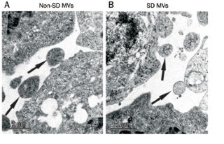 Serum deprivation elevates the levels of microvesicles with different size distributions and selectively enriched proteins in human myeloma cells in vitro